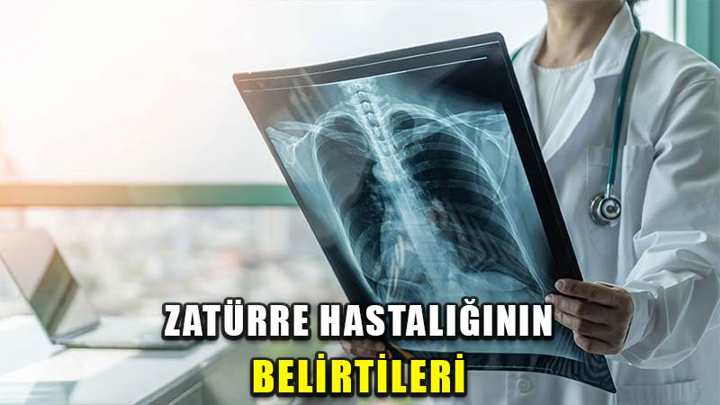 Zatürre hastalığının belirtileri