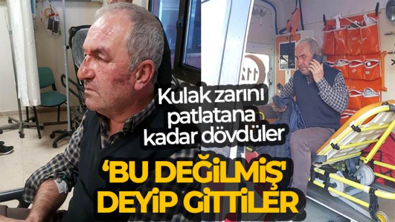 Kulak zarını patlatana kadar dövdüler, ‘Bu değilmiş' deyip gittiler