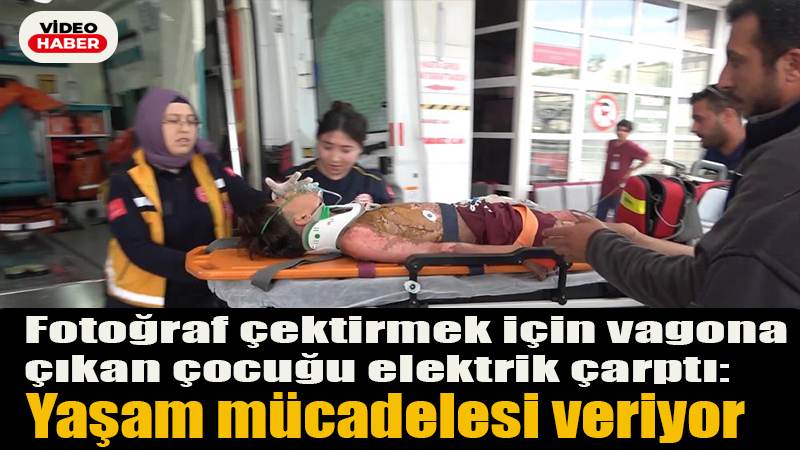 Fotoğraf çektirmek için vagona çıkan çocuğu elektrik çarptı: Yaşam mücadelesi veriyor