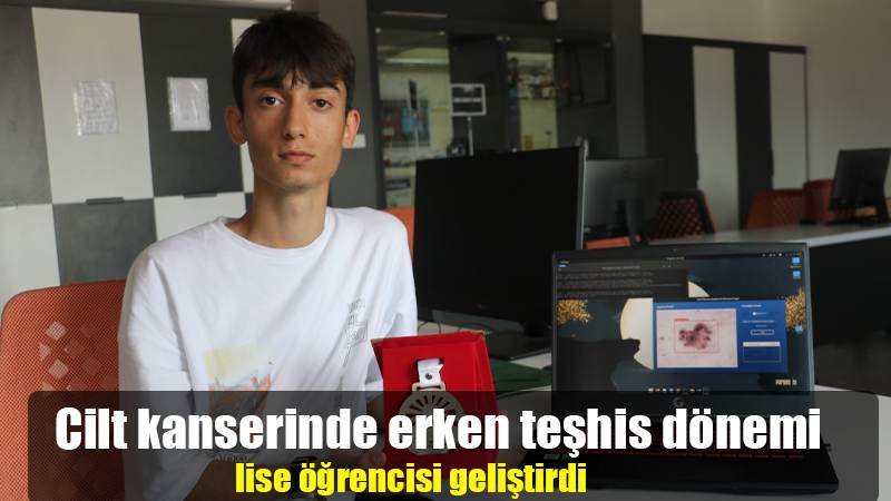 Cilt kanserinde erken teşhis dönemi. Lise öğrencisi geliştirdi